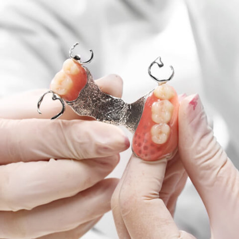 protesis dental