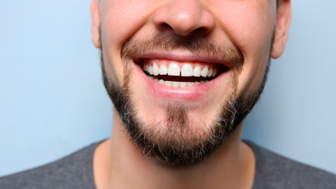 Sonrisa gingival: cómo corregirla