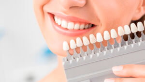 Blanqueamiento dental interno