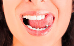 Piercings en la lengua: consecuencias bucodentales