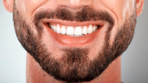 Stripping dental: qué es, ventajas y desventajas