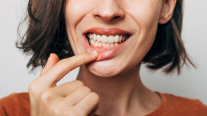 Diferencia entre gingivectomía y gingivoplastia