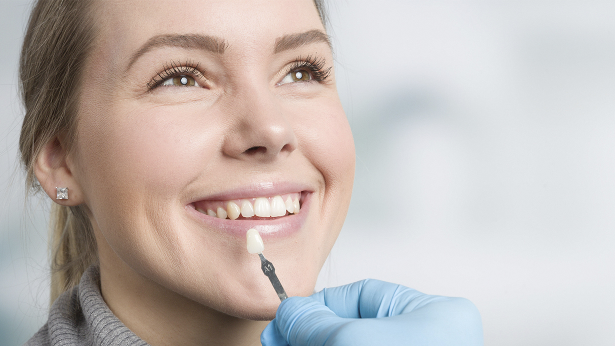 ¿Qué es una corona dental?