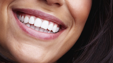 ¿Cuánto dura una limpieza dental profunda?