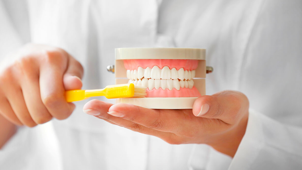 Cálculo dental: qué es, diferencias y cómo eliminarlo