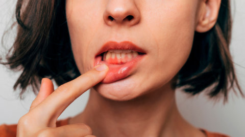 ¿Qué es la piorrea dental y cómo se cura?