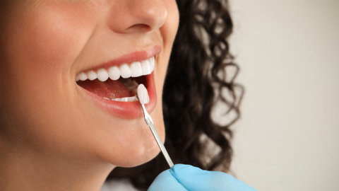 Microcarillas dentales: ventajas y desventajas