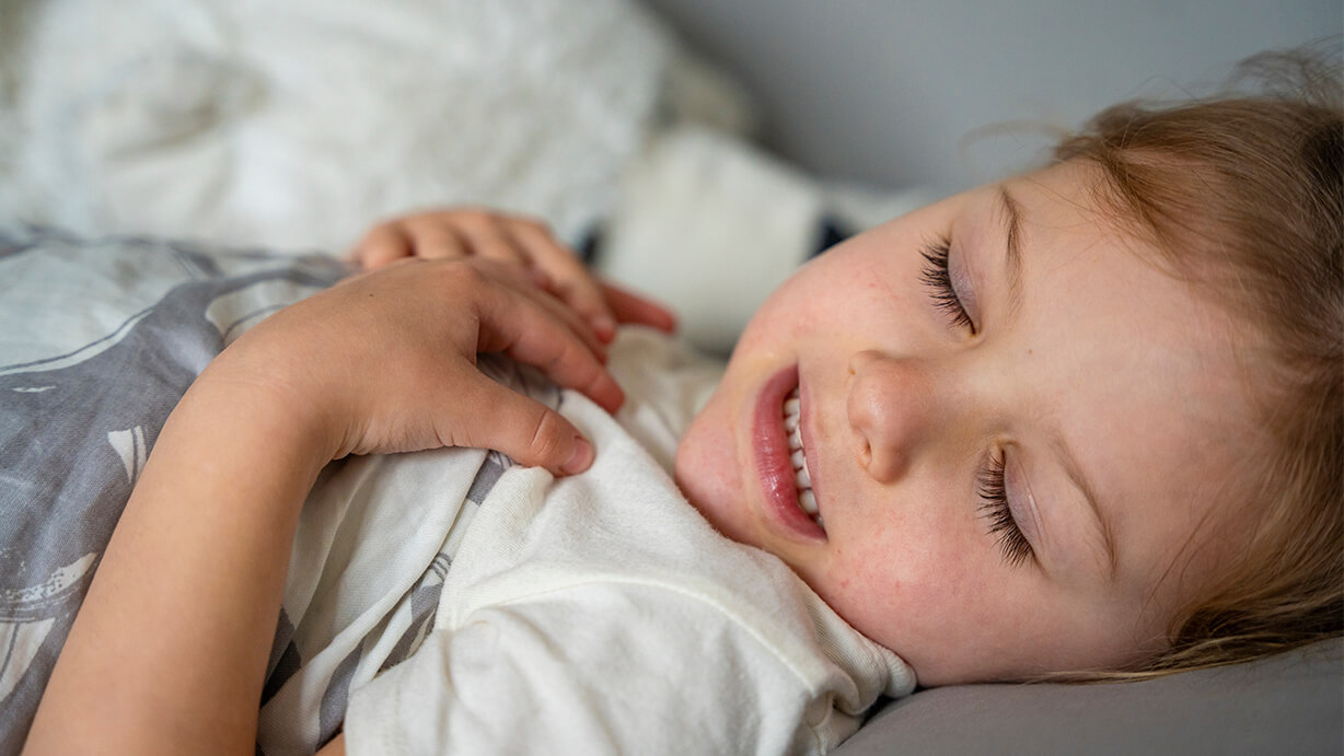 ¿Qué es el bruxismo infantil y cómo detectarlo a tiempo?