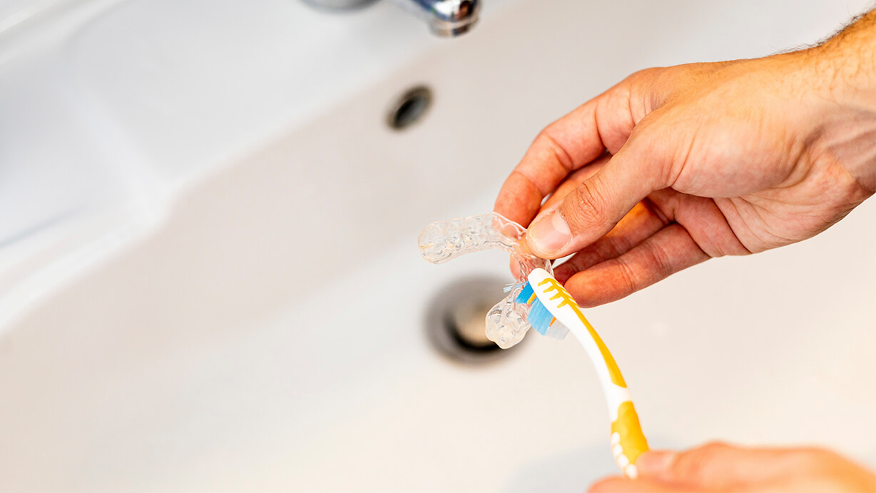 ¿Cómo limpiar una férula dental? Paso a paso