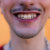 Grillz dentales: todo lo que debes saber