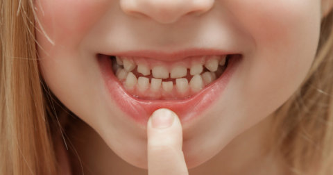 Dentición temporal: todo lo que necesitas saber