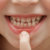 Dentición temporal: todo lo que necesitas saber