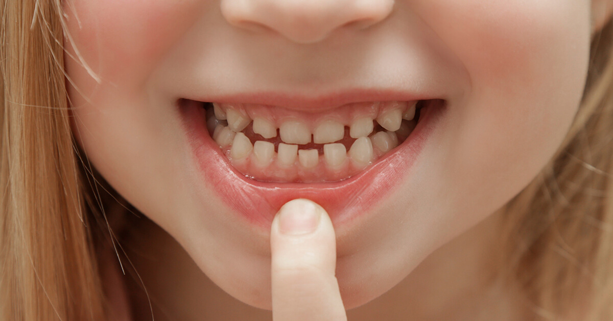 Dentición temporal: todo lo que necesitas saber